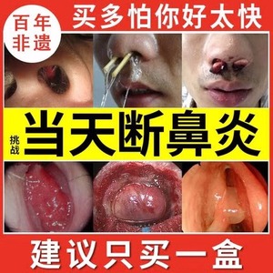 鼻炎膏儿童过敏性鼻窦炎鼻甲肥大通气鼻塞通鼻神器鼻息肉苍耳子油