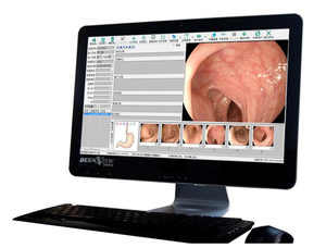 高清DVI胃肠镜内窥镜索图高清内镜软件高清采集卡连接线脚踏开关