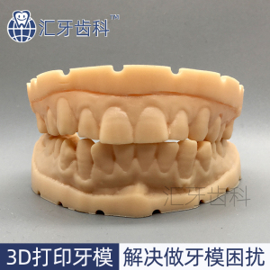 3D牙模打印长期保存重复用齿科树脂模型石膏牙模复制牙齿扫描数据