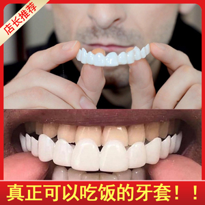牙套吃饭神器 成人老人缺牙牙缝黄牙临时遮丑通用硅胶套 仿真牙齿