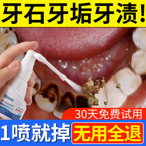 牙结石去除器溶解除牙石非速效漱口水洗牙黄牙垢牙齿污垢清除神器