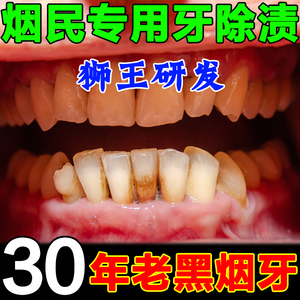 洗牙粉亮白去黄去烟渍牙斑净牙齿美白速效黄牙除牙结石神器薄荷粉