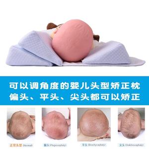 宝宝斜颈纠正神器歪脖子偏头矫正器新生儿定型枕头可调节透气枕