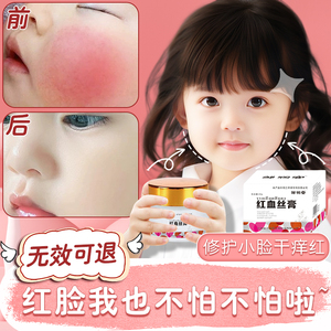 红脸蛋修复儿童去红血丝修复角质层薄大红脸面霜3岁以上宝宝泛红