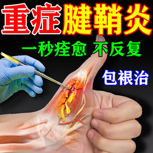 专治大拇指腱鞘炎的药贴膏键健鞘稍炎专用膏药正品治特效护腕部位