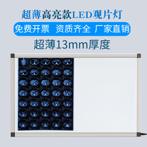 高亮超薄X光观片灯箱医用led阅片灯看片灯双联三联观片灯骨科核磁