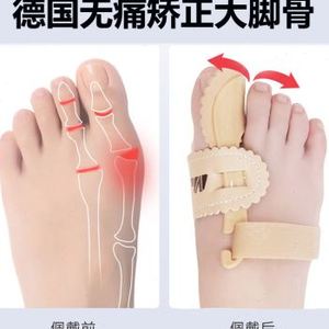 新敏斯特拇指外翻矫正器母脚指头保护套大母足大脚骨可穿鞋男女品