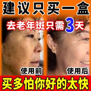 老年斑强力祛除去斑黄褐斑雀斑官方正品祛老人手部脸部斑专用祛霜