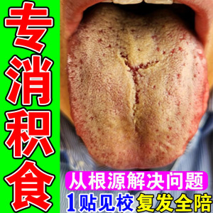 仁和小儿健脾消积食贴鸡内金婴幼儿童脾胃腹胀气调理化食贴去内热