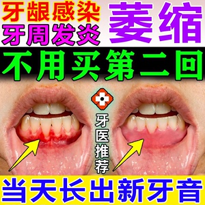 牙痛消炎牙龈肿痛萎缩修补膏齿松动修复再生中特效药抗菌专用牙膏