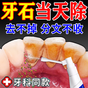 牙结石溶解牙石速效清理神器医用洗牙齿污垢专用漱口水牙石溶解剂