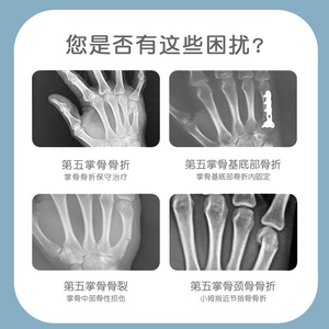 第五掌骨骨折手指指套手掌小拇指支具固定器手腕夹板固定护具