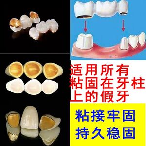 牙科自己动手粘烤瓷牙胶水牙齿钢牙套牙冠假牙专用牙科胶水粘接剂