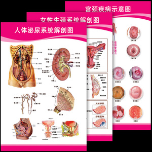 宫颈疾病示意图 女性生殖器系统解剖图女性子宫图片妇科海报挂图