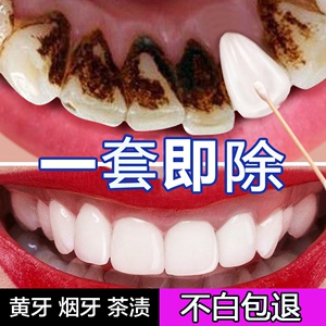 强力去烟渍牙膏洗牙粉溶解牙结石祛除器牙齿美白速效黄牙亮白口臭