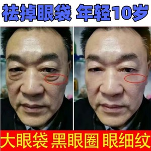 眼霜眼袋去除神器专用淡化细纹黑眼圈提拉紧致男士旗舰店官方正品