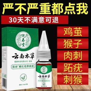 云南本草鸡眼药水藏红花抑菌液去除手足部脚底老茧肉刺根脚跖尤膏