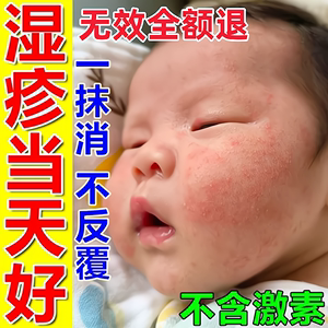 湿疹婴儿专用宝宝湿疹膏无激素儿童特应性皮炎身体乳克星止痒去根