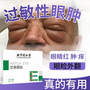 眼皮红肿痒疼痛眼睛周围过敏发痒干燥发炎皮肿胀眼贴医用冷敷贴SK