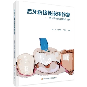 现货 后牙粘接性嵌体修复 微创与功能的融合之美 张林 等 四川科学技术出版社 适合中国牙医的嵌体修复书籍 口腔医学 口腔修复补牙