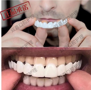 牙套吃饭神器 蛀牙不齐缺牙缝遮盖通用美白假牙齿 美观牙贴假牙套