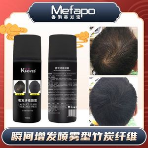 增发纤维喷雾密发纤维粉快速补发际线头发填充增多日本假发美髪粉