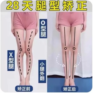 【日本骨グ科専研】O型X型小腿外翻矫正腿型直腿矫正鞋垫男女可用