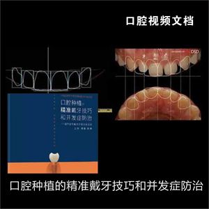 口腔种植的精准戴牙技巧和并发症防治 电子素材视频课程文档
