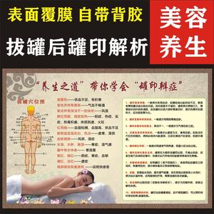 拔罐后罐印对应症状解析海报拔罐穴位挂图拔罐的好处中医养生理疗