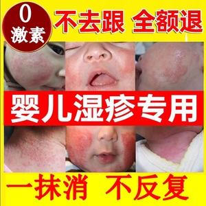宝宝湿疹膏婴儿专用儿童热痱子止痒去根口水疹淹脖子无激素护臀膏