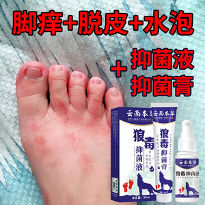 脚气去艮神器日本专用脚膜去死皮止痒抑菌药脚出汗臭脚止汗喷雾剂