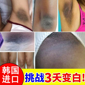 胳膊肘去黑去死皮腋下膝盖关节腋窝美白手肘指脚脖子夏天变白神器