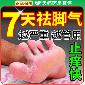 儿童治疗脚气专用药灰指甲丁克盐酸特比萘芬乳膏软膏喷雾剂正品QF