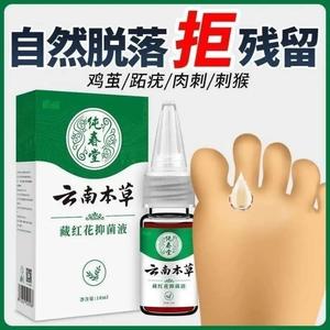 纯春堂云南本草藏红花抑菌液ml成人鸡眼膏去手足脚底老茧肉刺趾尤