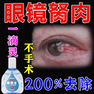 拨云锭眼液胬肉滴眼液明目退翳眼药水止痒消炎杀菌干涩不含防腐剂