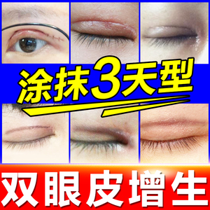 双眼皮祛疤贴疤痕增生修复去疤膏开眼角手术后除疤医用硅酮凝胶bc