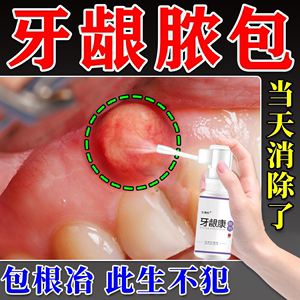 牙龈脓包专用喷剂牙根发炎牙龈肿包肿痛消炎药牙肉增生上火牙龈炎