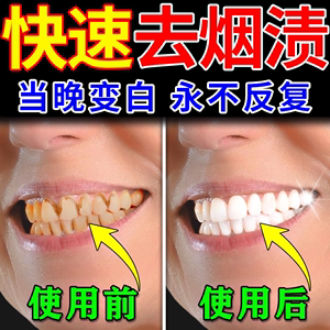 强力去烟渍牙膏去牙渍牙垢黄牙结石黑黄色茶渍牙美白去除口臭神器