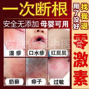 湿热疹宝宝奶藓口水疹根去专用婴幼儿童身脸上过敏红疹抑菌止痒膏