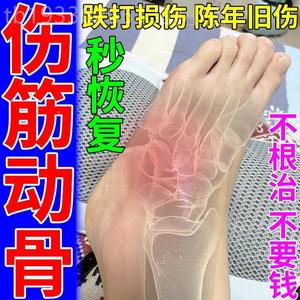 伤筋动骨膏药泰国跌打损伤脚踝扭伤消活血化肿散淤舒筋止痛外用贴