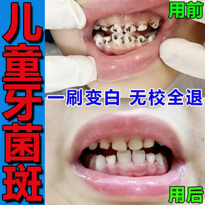 儿童牙菌斑祛除神器黑色素沉淀清洁美白小苏打牙膏固齿防蛀专用