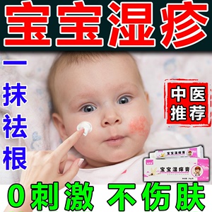 宝宝身体乳干性湿疹儿童湿疹霜特应性皮炎止痒去根湿疹膏婴儿专用