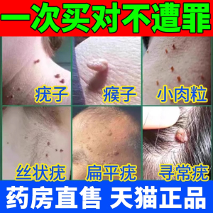 云南本草去除疣瘊肉粒鸡眼扁平疣专药用丝状一抹无忧趾疣克净药膏