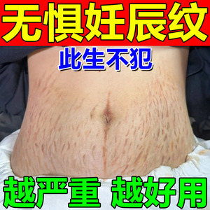 妊辰纹消除去妊娠纹紧致肚皮去肥胖纹修复霜生长纹消除大腿纹药膏