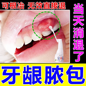 牙龈脓包专治牙根发炎肿包牙肉肿痛上火鼓包出血消炎药牙康灵喷剂
