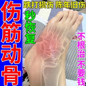 直供伤筋动骨膏药泰国跌打损伤脚踝扭伤消活血化肿散淤舒筋止痛外