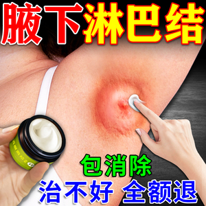 腋下淋巴疏散神器治脖子淋巴结节疏通去副乳肿大排毒消除解散药膏