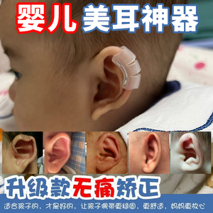 日本进口婴儿耳朵矫正器耳夹耳撑杜宾立耳器后撑支撑贴防压神器