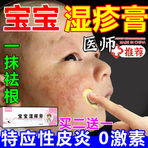 宝宝身体乳干性湿疹霜儿童特应皮炎止痒去根湿疹膏婴儿专用无激素