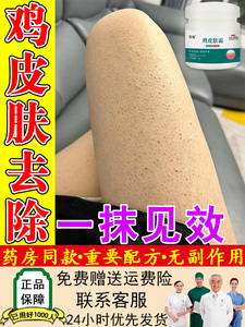 鸡皮肤疙瘩毛囊角化专用药膏腿部粗糙小颗粒毛周角化症美白身体乳